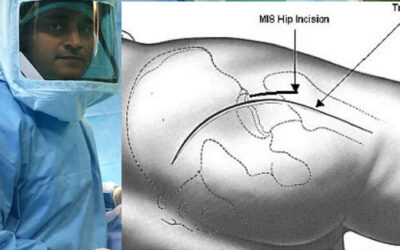 Minimally Invasive HIP Replacement