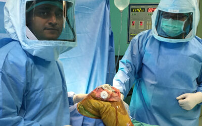 Partial Knee Replacement