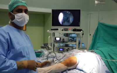 Knee Arthroscopy