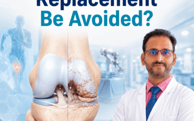 Can Knee Replacement Be Avoided?